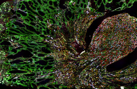 Kidney Disease Initiative