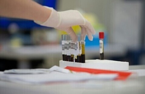 gloved hand picks up a vial of blood.