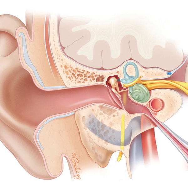   Stanford Otology Update 2026
