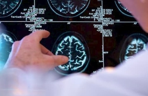 Image of Neurology Grand Rounds