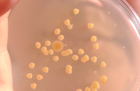 What appears to be a closeup of a petri dish in someone's hand.