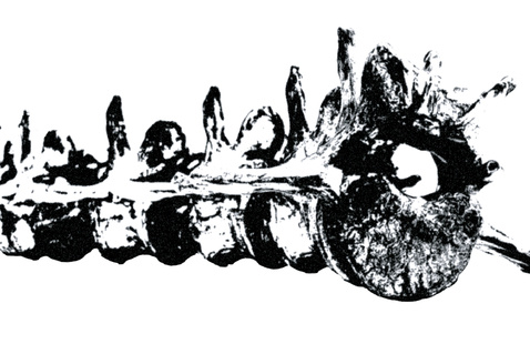 black and white sketch artwork of spinal column