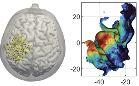 Mapping the Motor System with Brain Stimulation